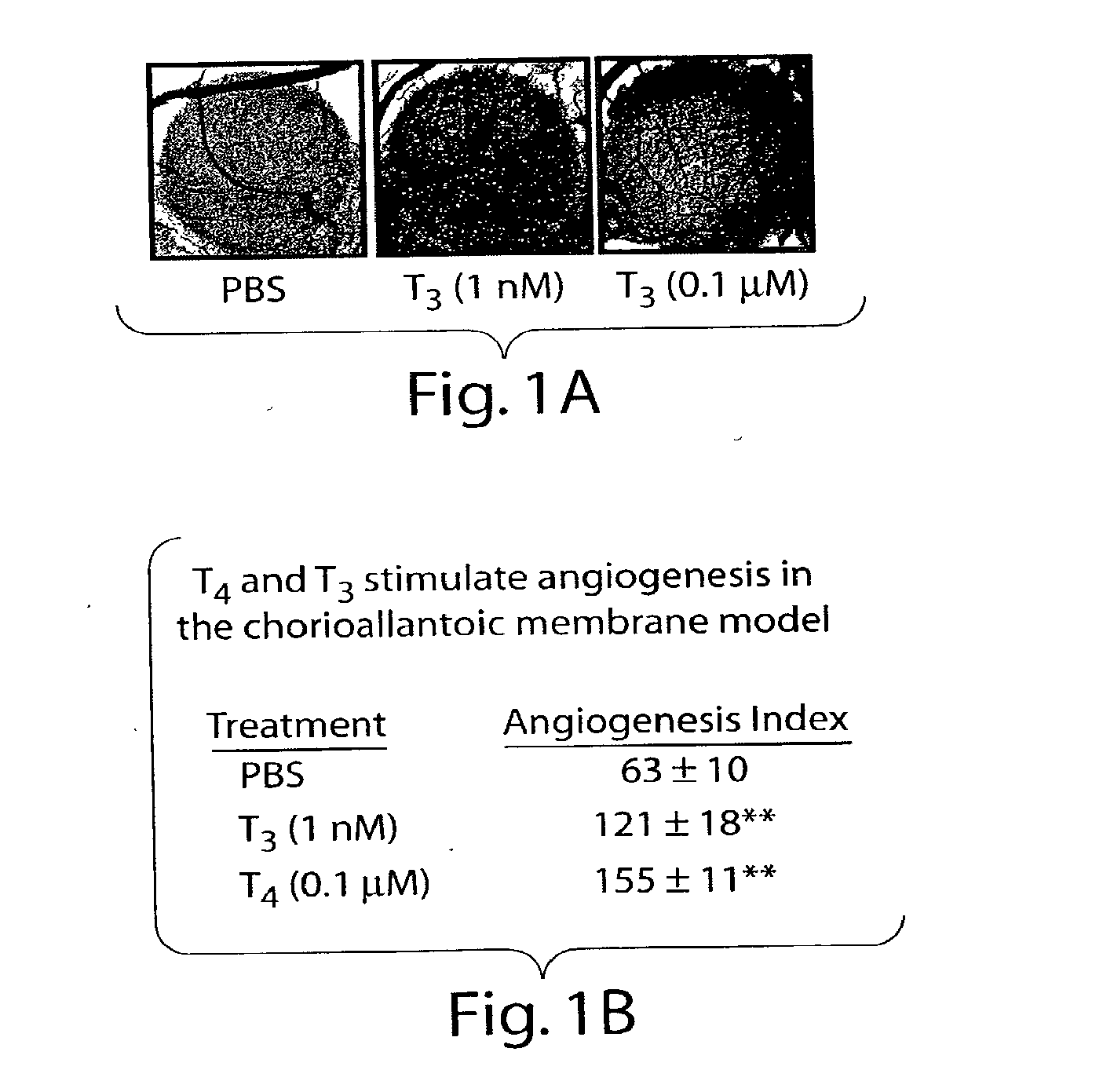 Thyroid hormone analogs and methods of use