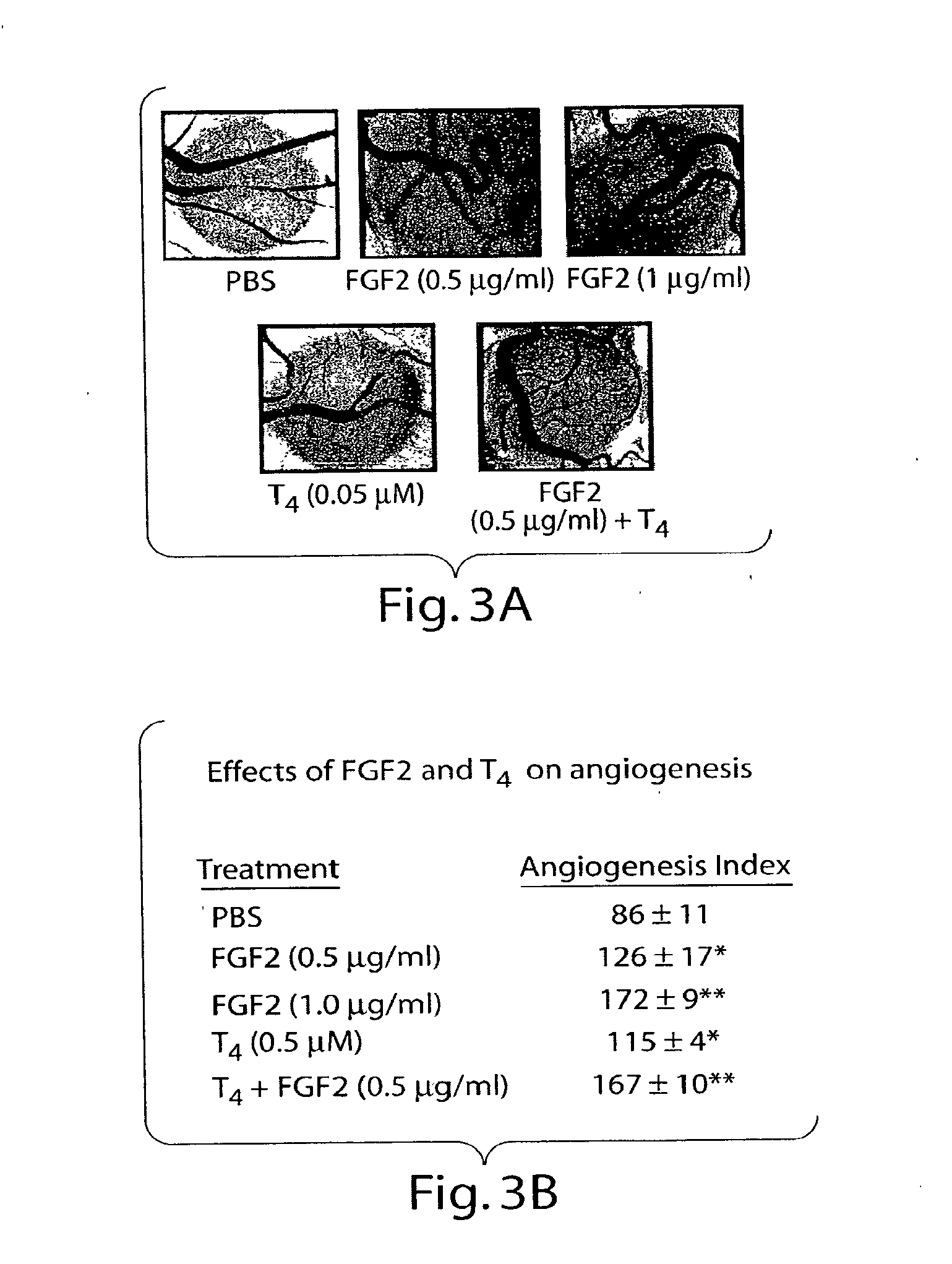 Thyroid hormone analogs and methods of use