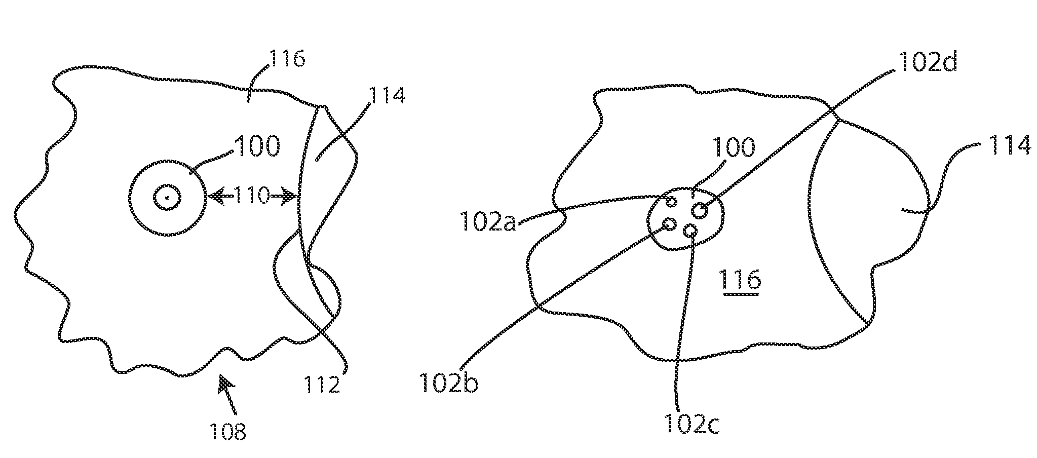 Glaucoma drainage device and uses thereof