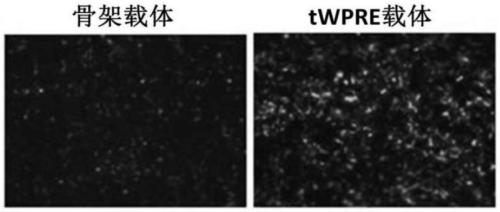 Nucleotide sequence tWPRE and gene expression vector and application thereof