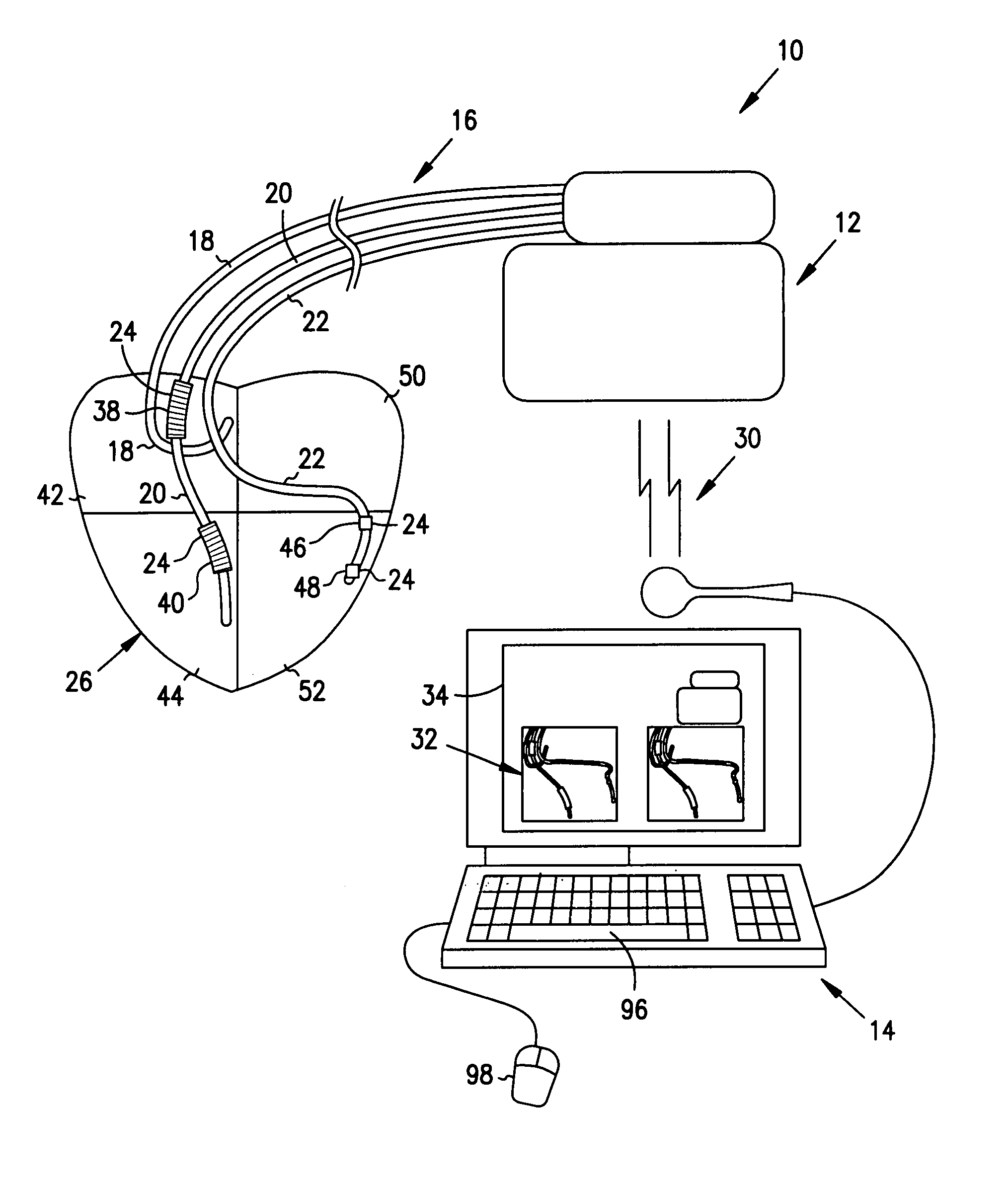 System and method for graphically configuring leads