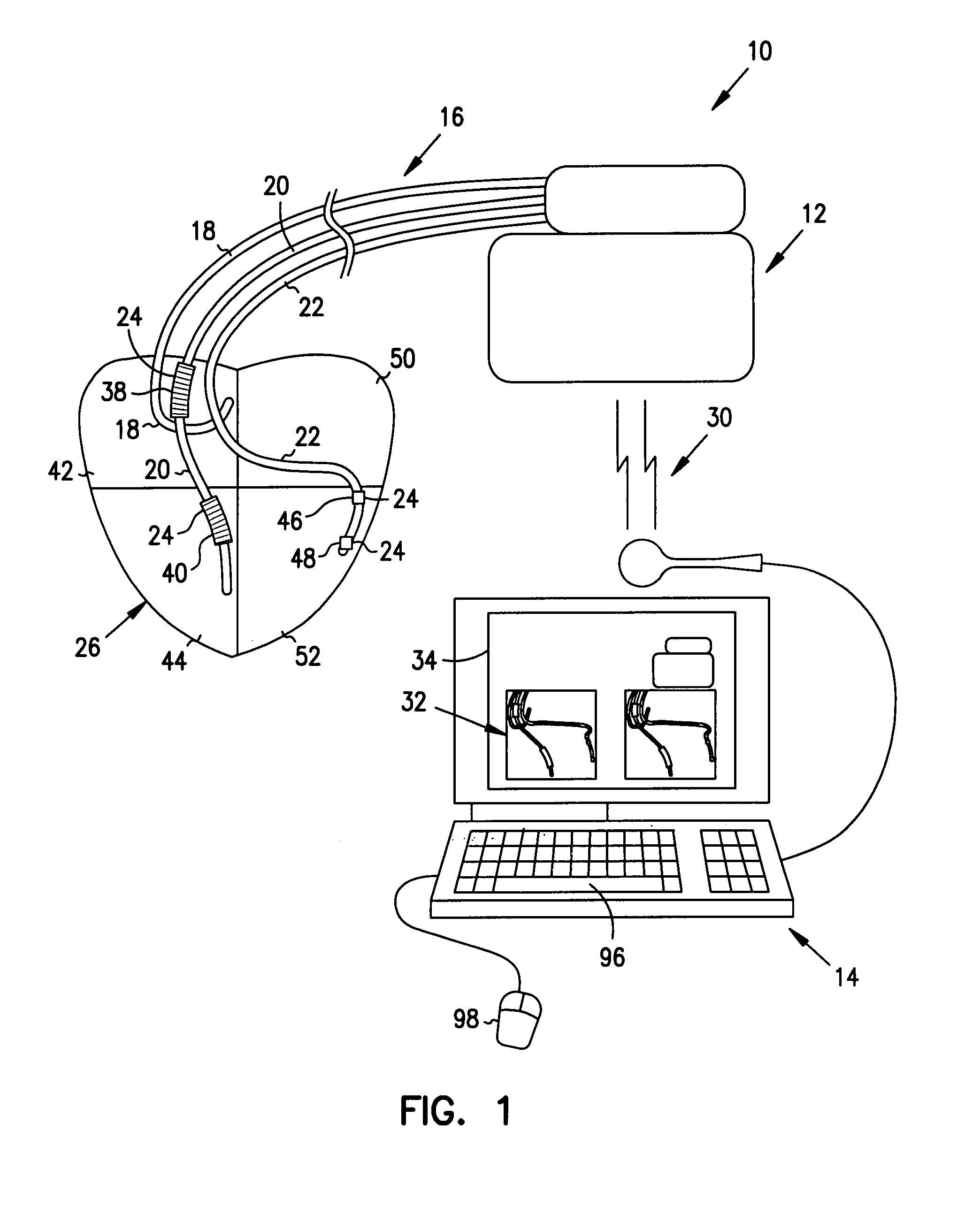 System and method for graphically configuring leads