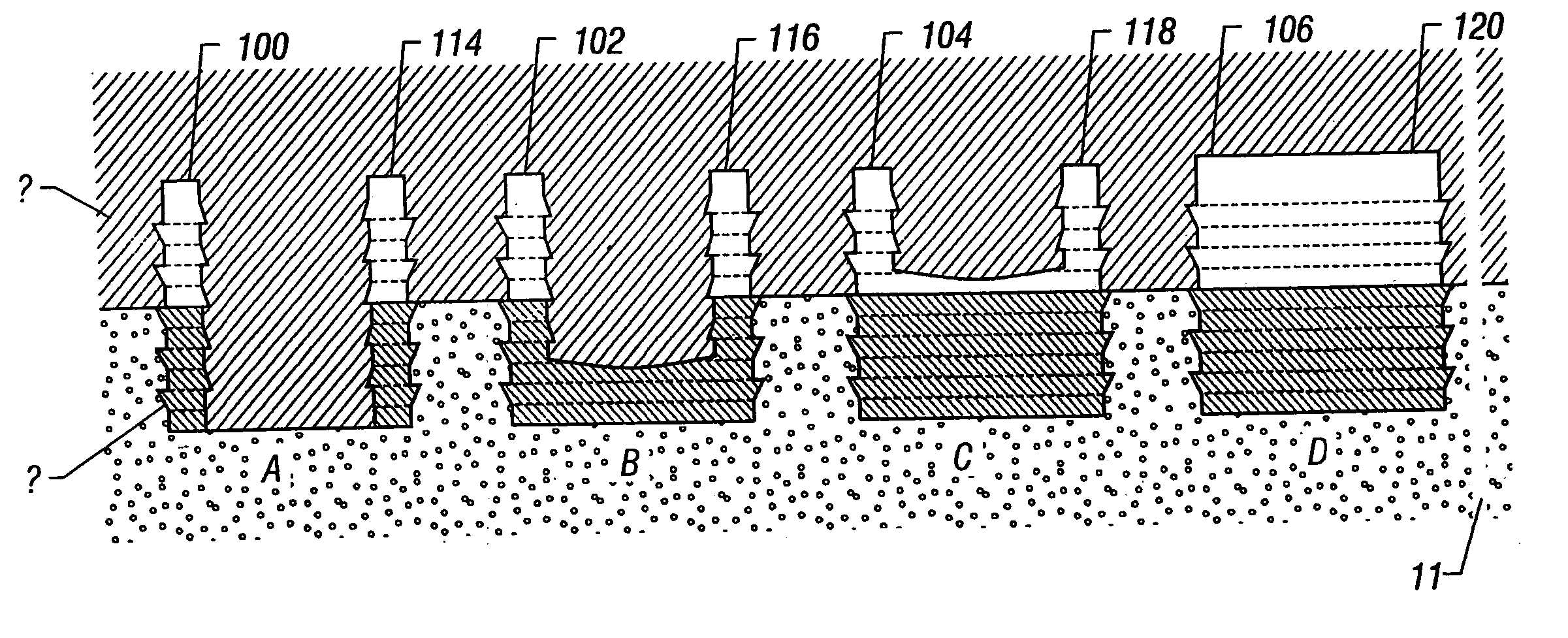 Cartilage repair plug