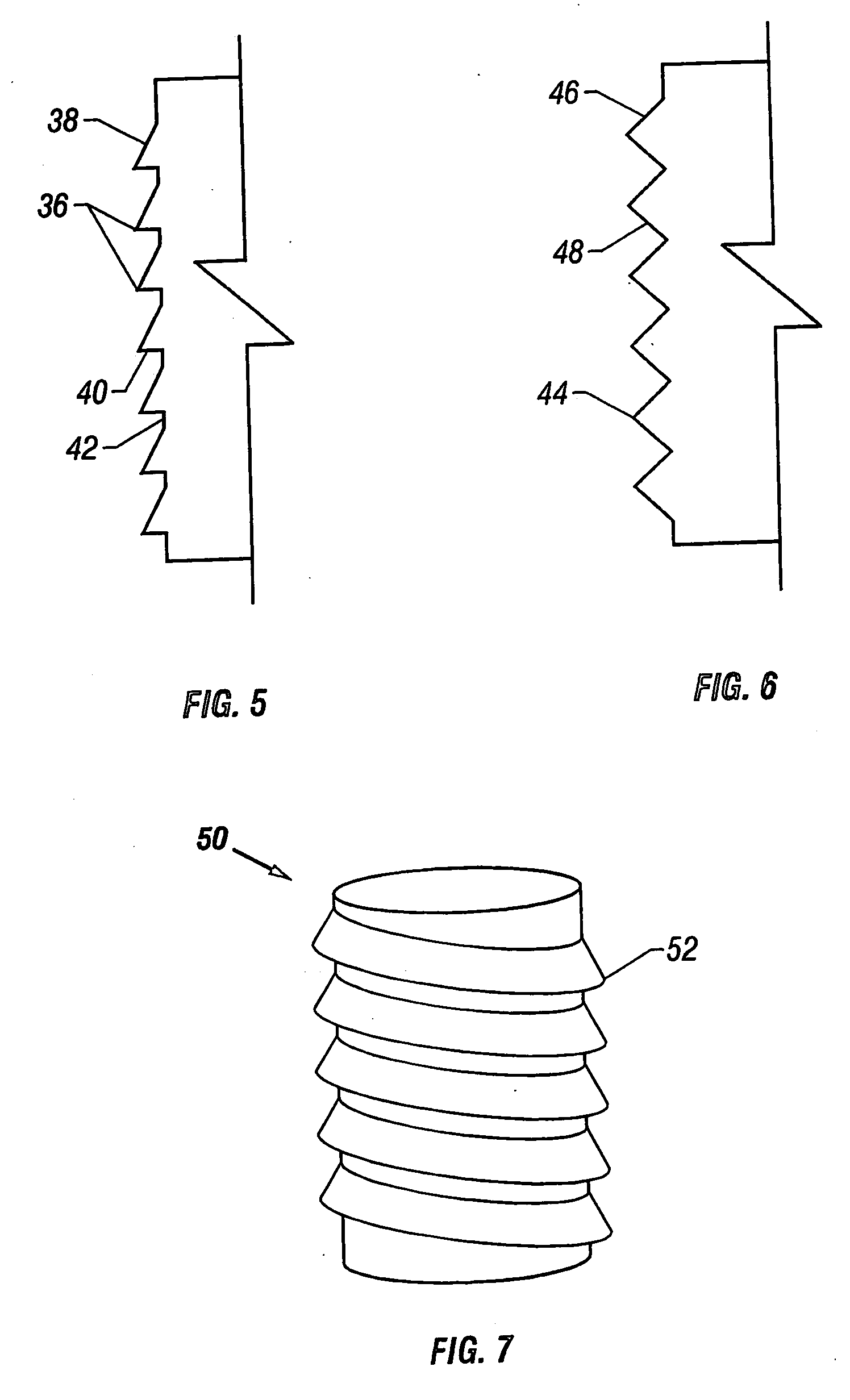 Cartilage repair plug