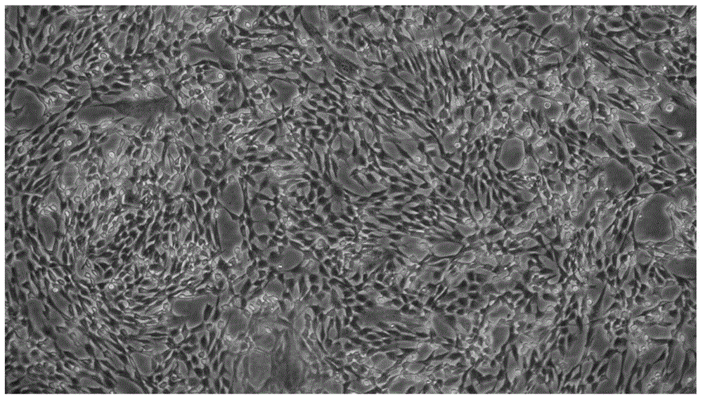 Method for preparing chorionic mesenchymal stem cells