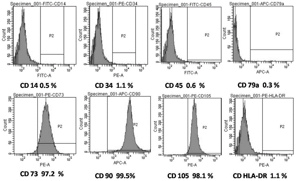 Method for preparing chorionic mesenchymal stem cells