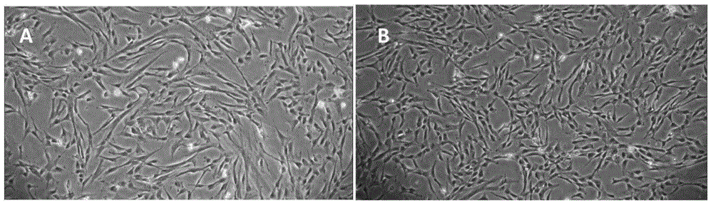 Method for preparing chorionic mesenchymal stem cells