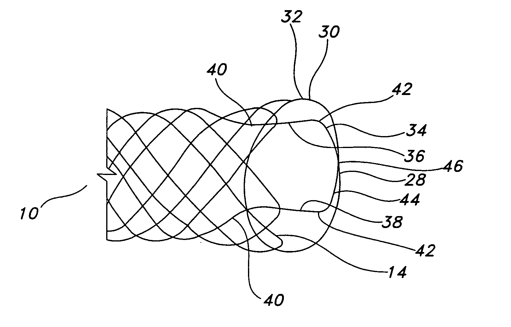 Integrated stent repositioning and retrieval loop