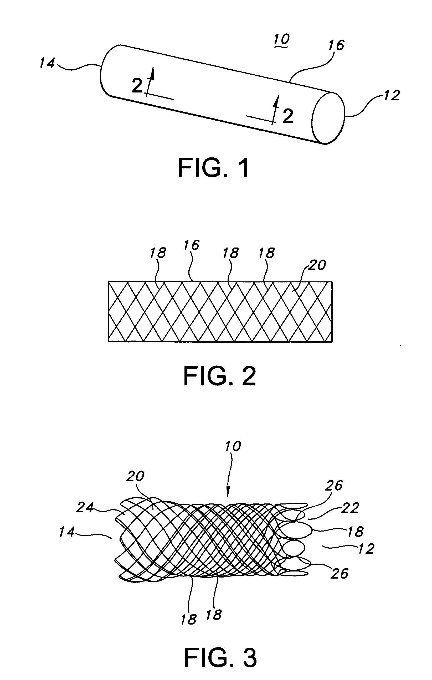 Integrated stent repositioning and retrieval loop