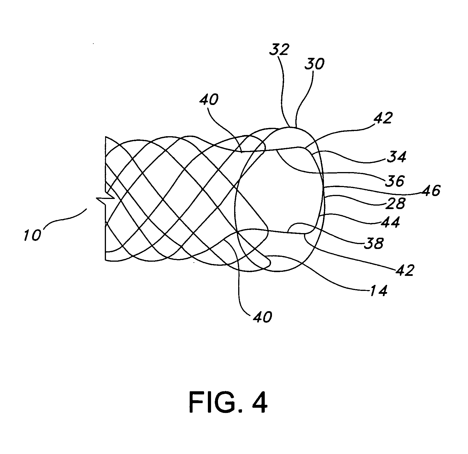 Integrated stent repositioning and retrieval loop