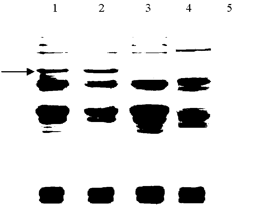 Anti-malignant lymphoma fusion protein and preparation method thereof