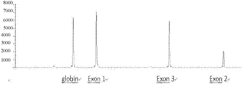 Kit for diagnosing Von Hippel-Lindau (VHL) disease