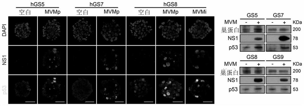 Treatment of cancer harboring mutations in the tp53 gene and/or post-translational modifications in the p53 protein with parvoviruses