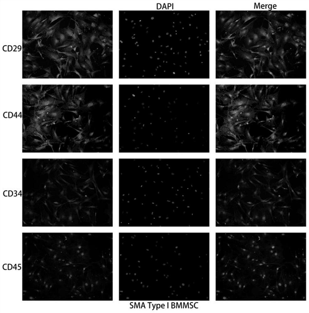 Establishment method and application of SMA model mouse bone marrow mesenchymal stem cells