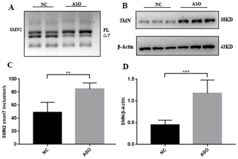 Establishment method and application of SMA model mouse bone marrow mesenchymal stem cells