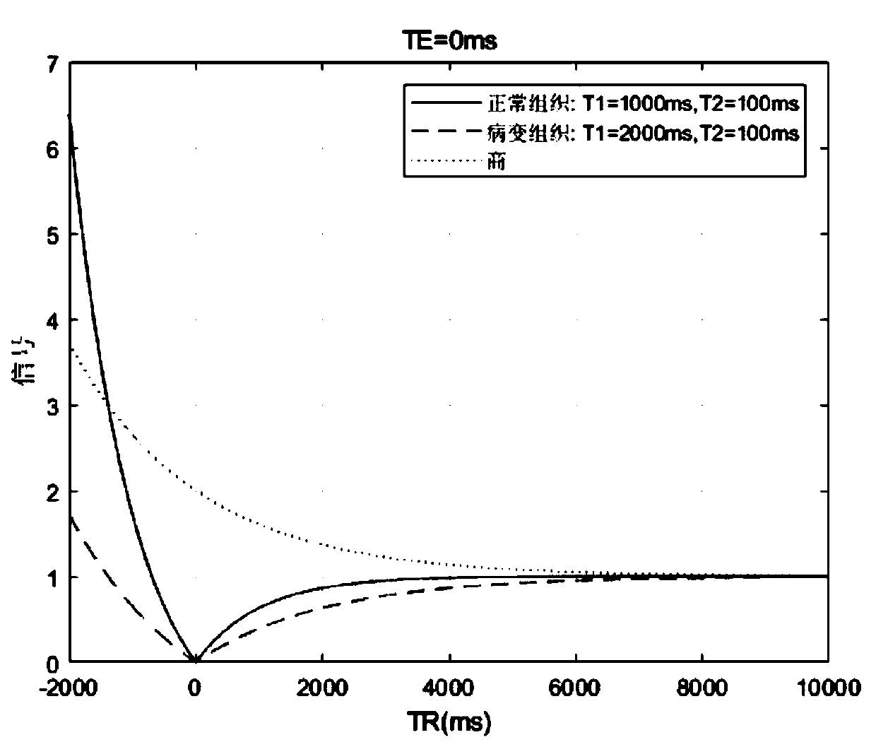 High-quality magnetic resonance image synthesis method