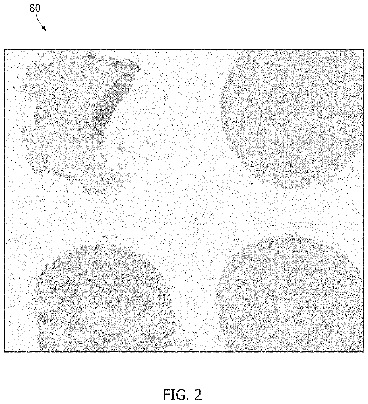 Image analysis in pathology