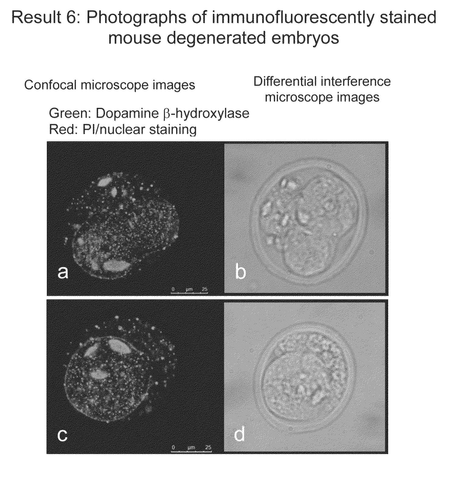 Method for evaluating human blastocyst by norepinephrine level in blastocyst culture solution