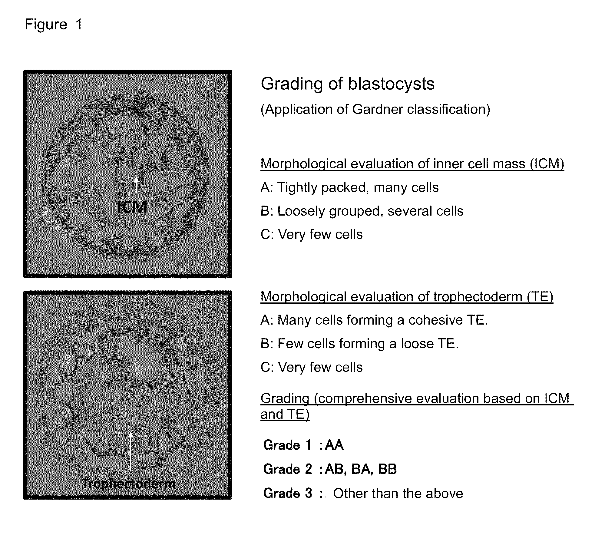 Method for evaluating human blastocyst by norepinephrine level in blastocyst culture solution