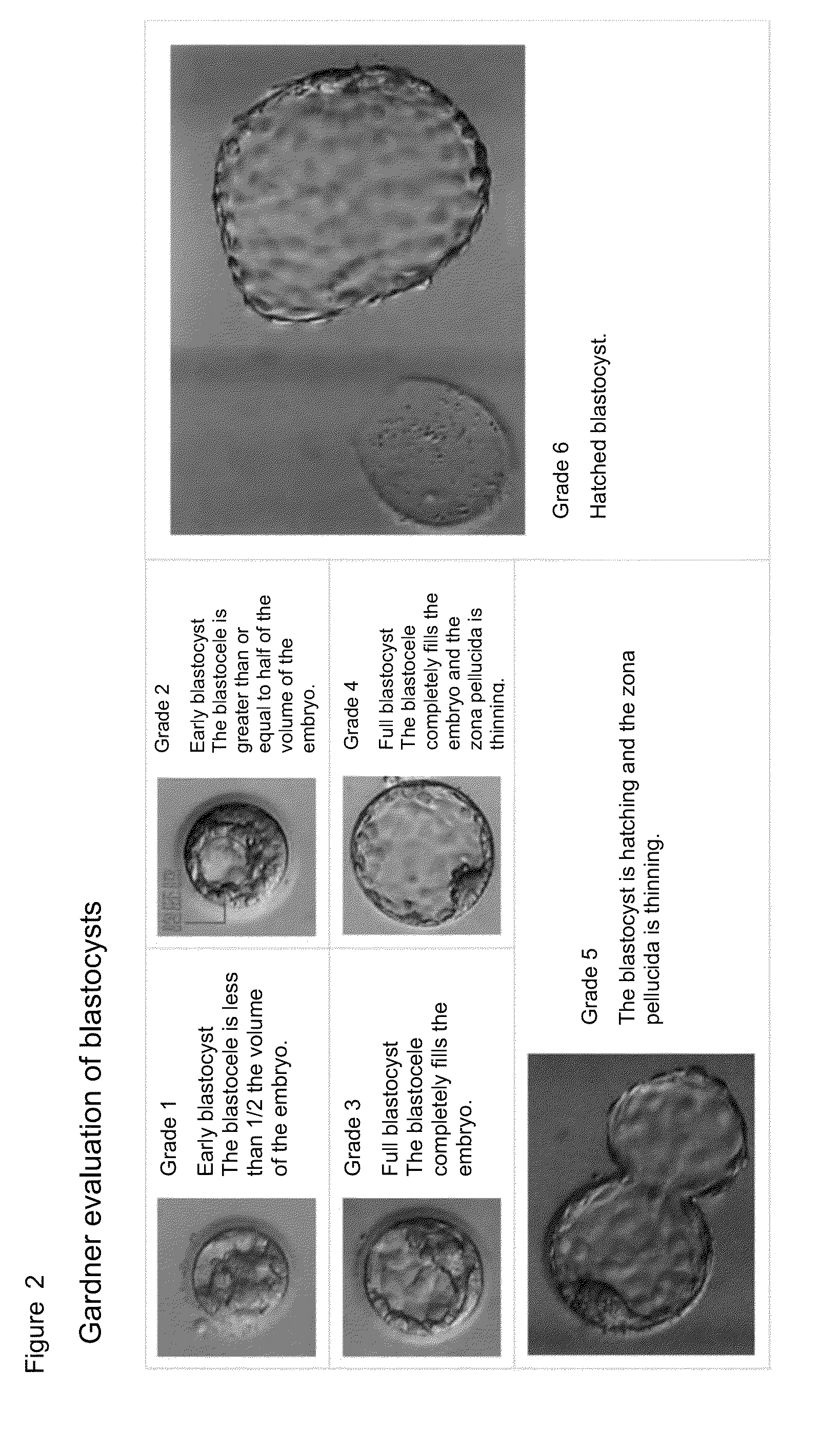 Method for evaluating human blastocyst by norepinephrine level in blastocyst culture solution