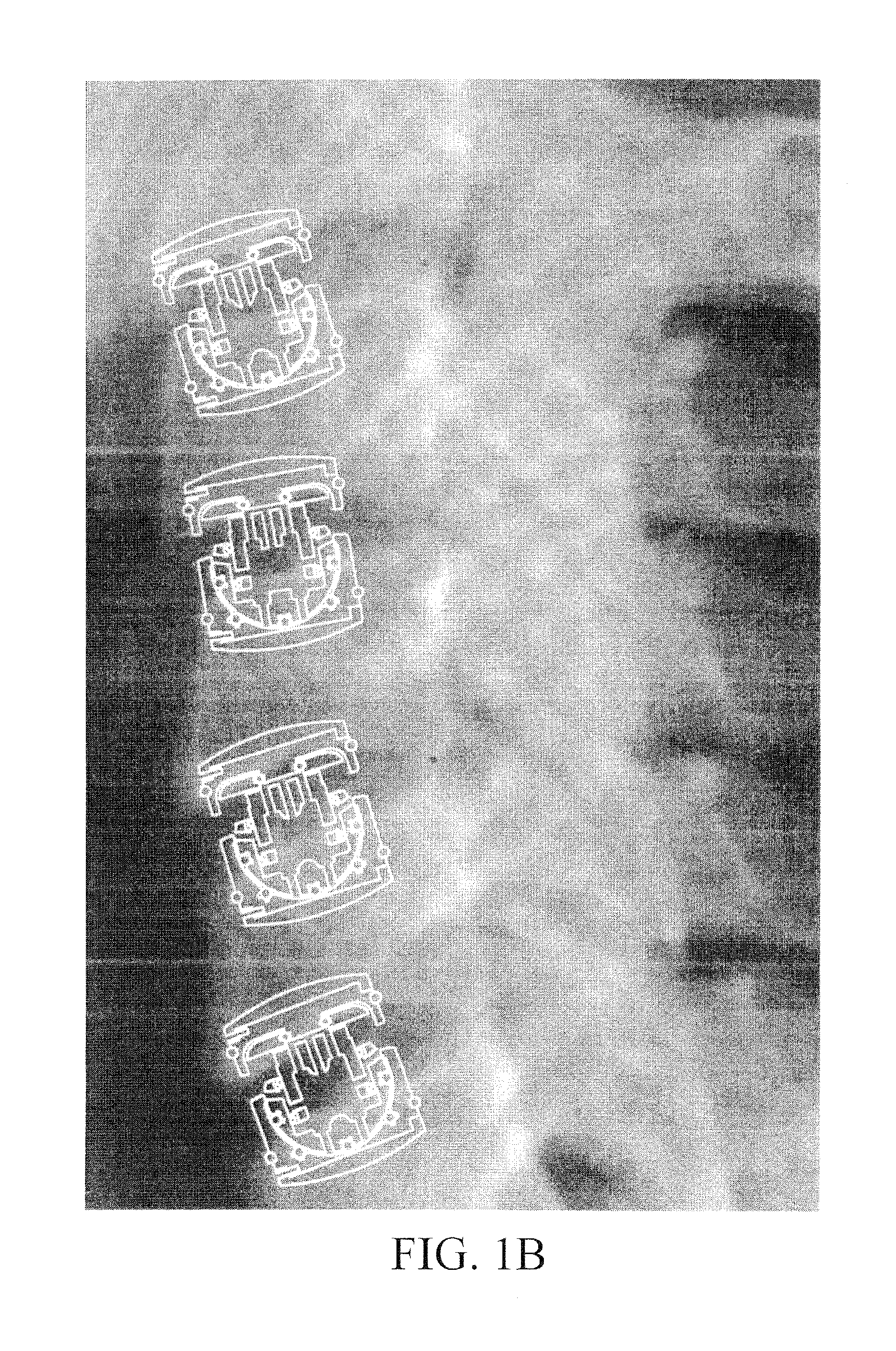 Spinal disc prosthesis and methods of use