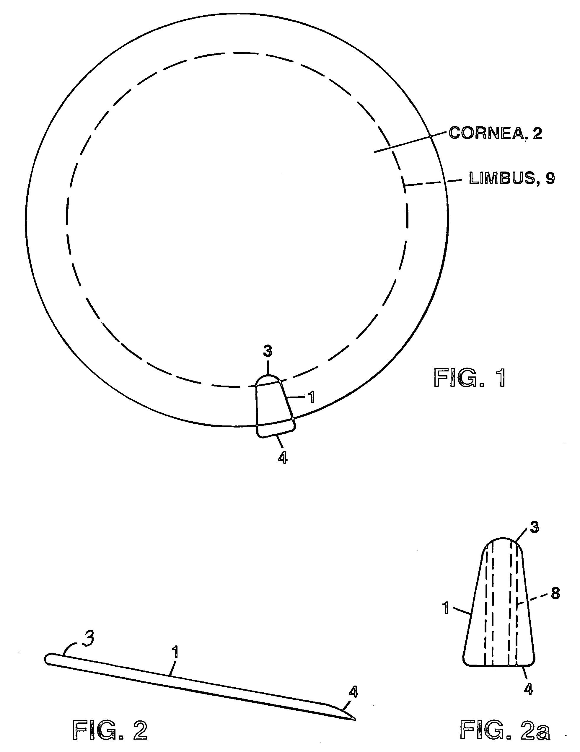 Trans-corneal shunt and method