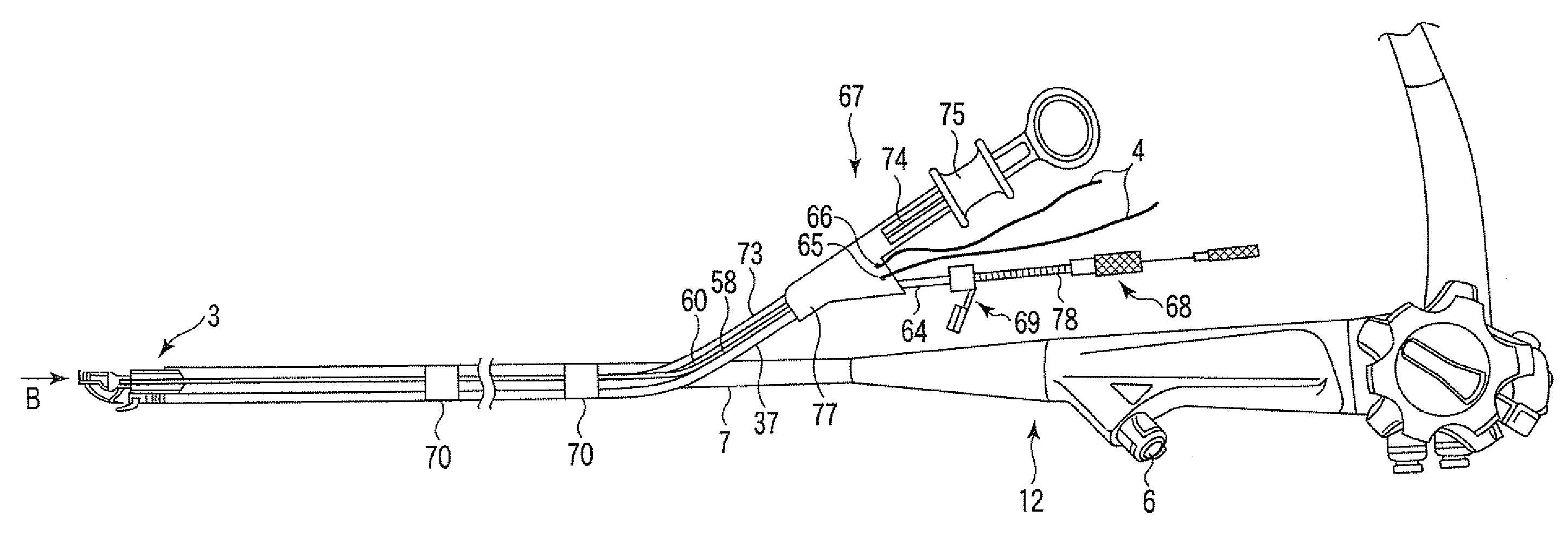 Endoscopic suturing system