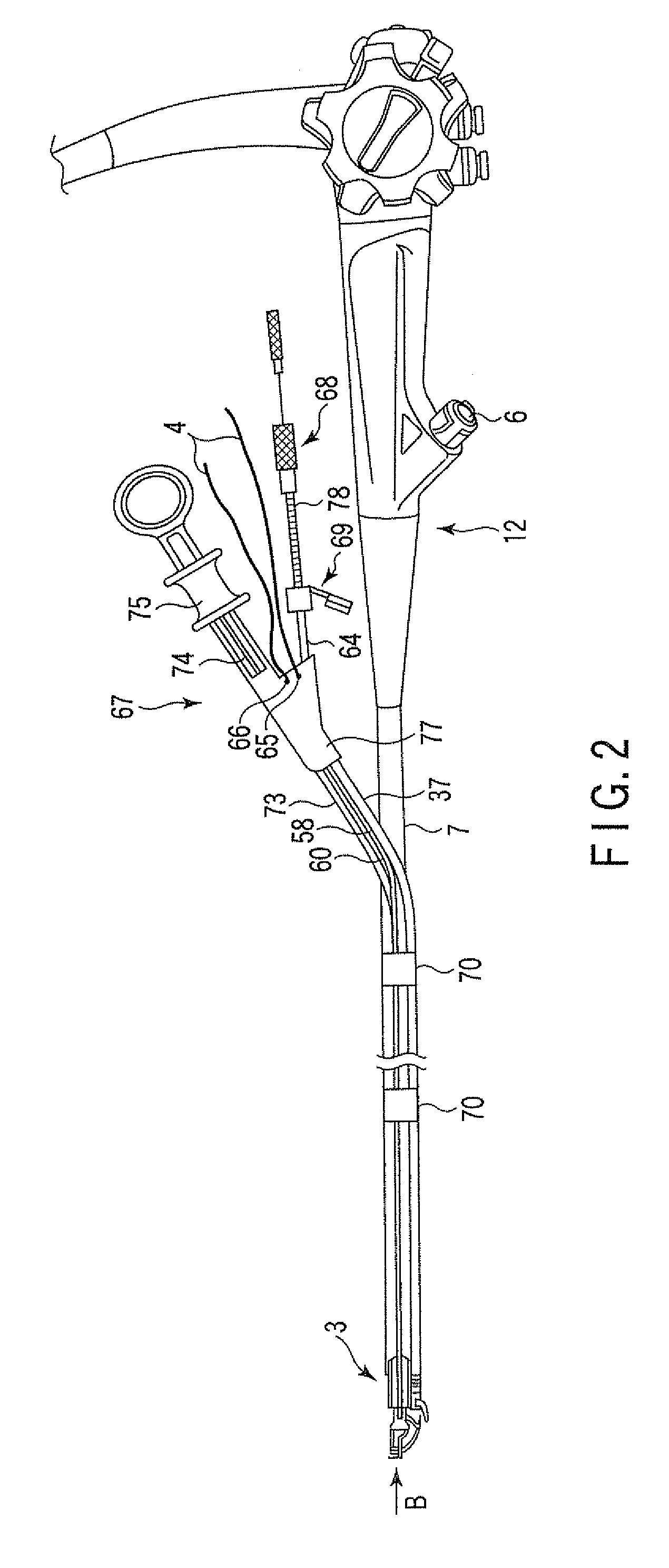 Endoscopic suturing system