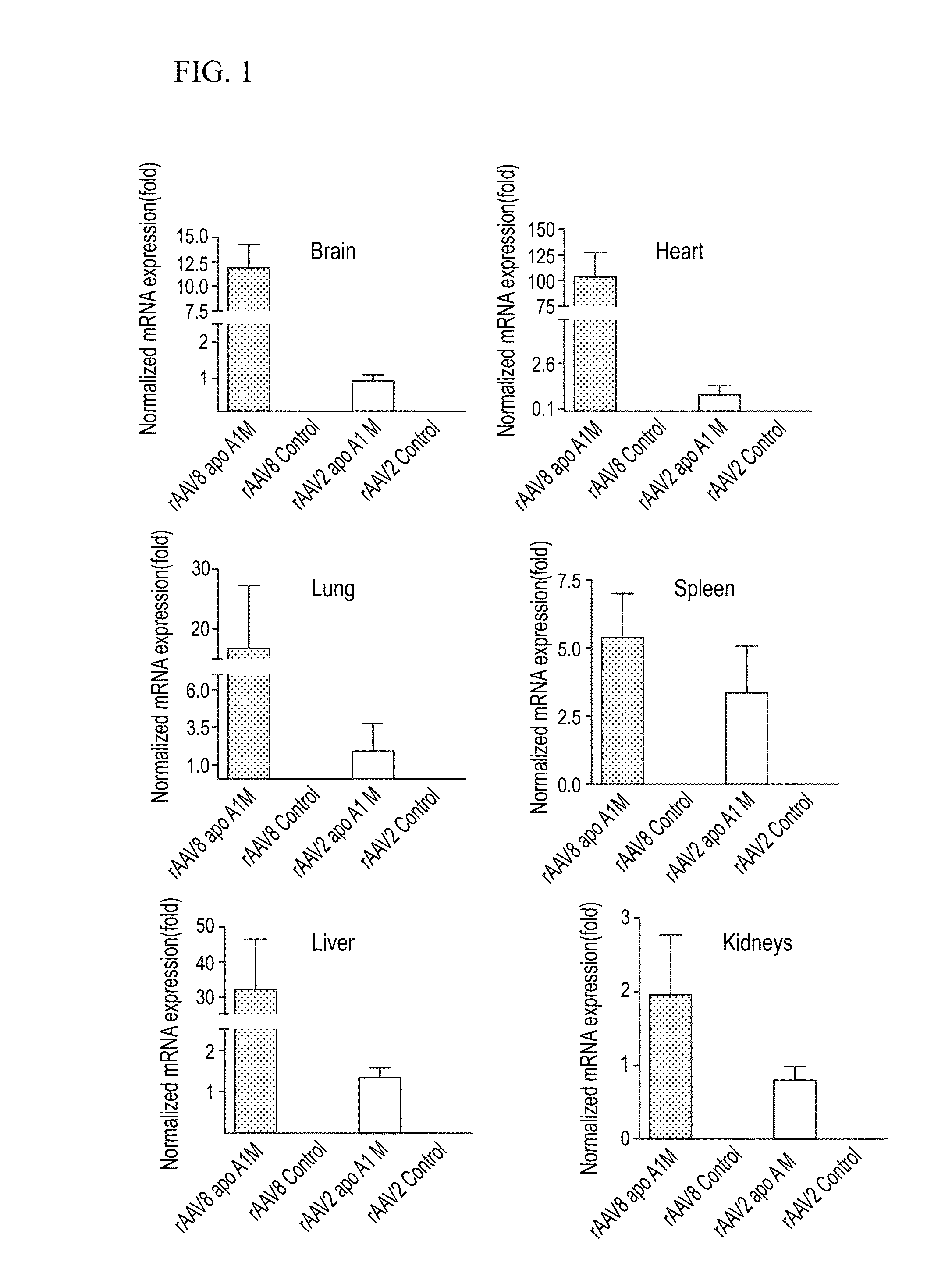 Methods of treating alzheimer's disease with apo a-1 milano