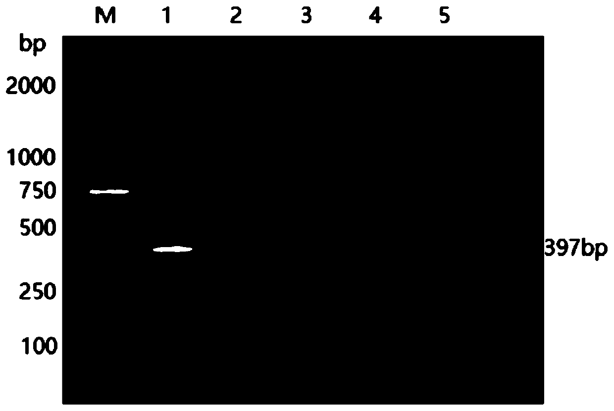 Fish pike fry rhabdovirus nested PCR detection primer group, kit and method and application