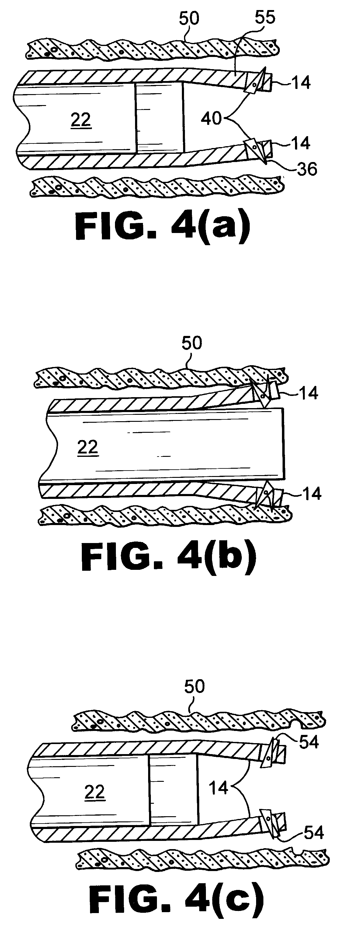 Biopsy device