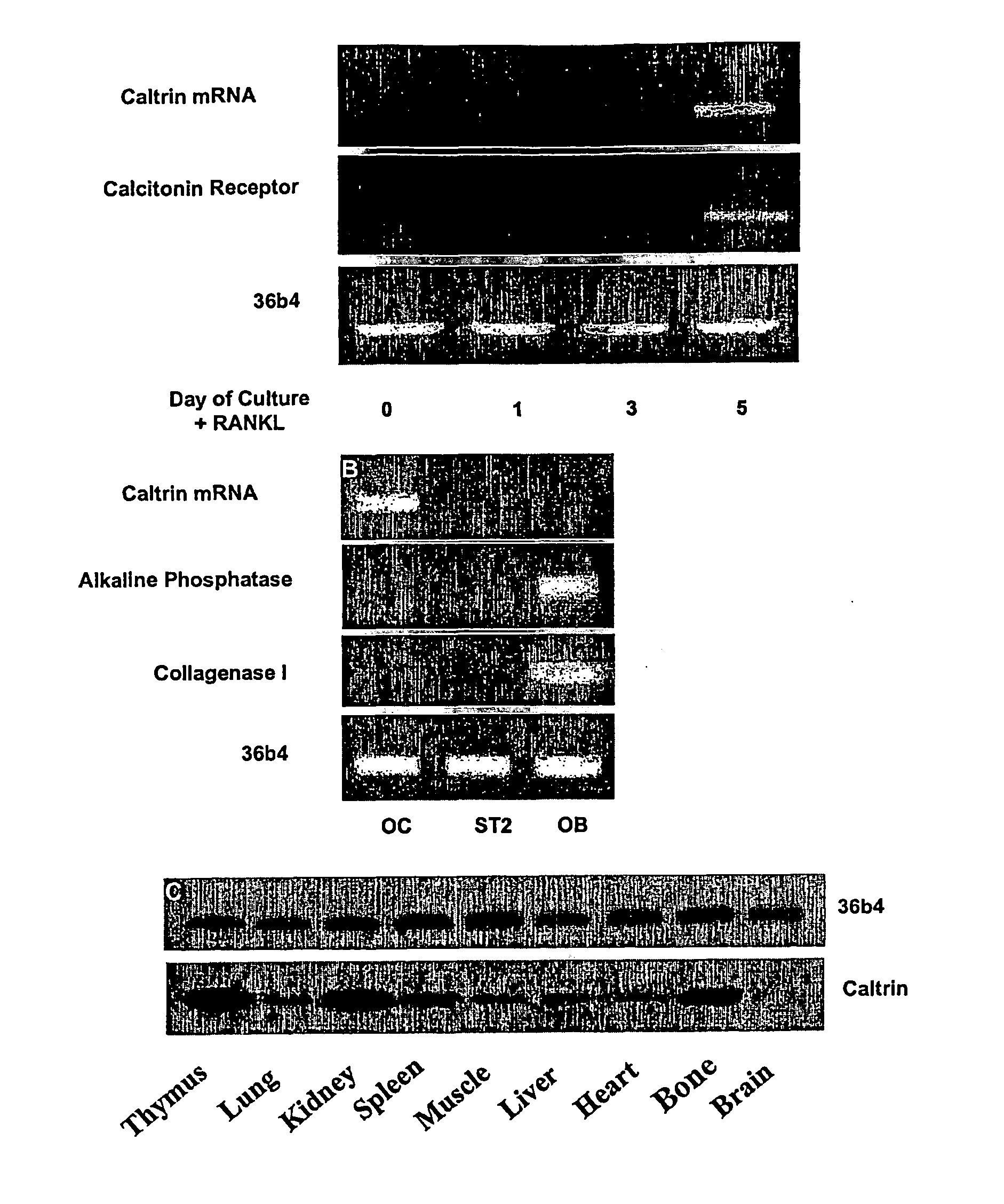 Osteoblast Growth Factor