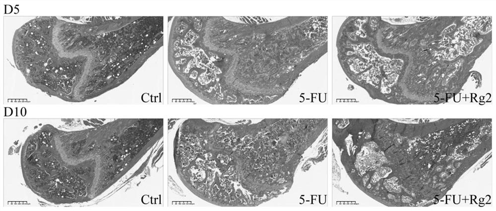 Use of ginsenoside Rg2 in preparing medicine for treating myelosuppression and medicine containing ginsenoside Rg2