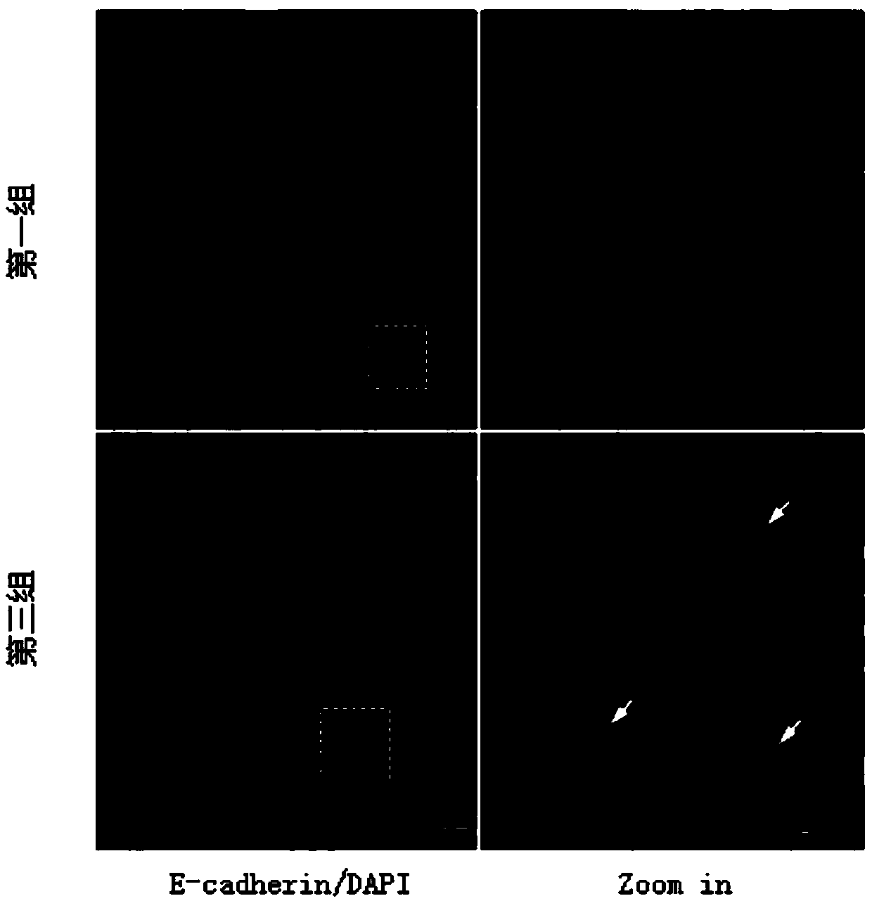 Animal model with cell-in-cell (CIC) structure and preparation method thereof