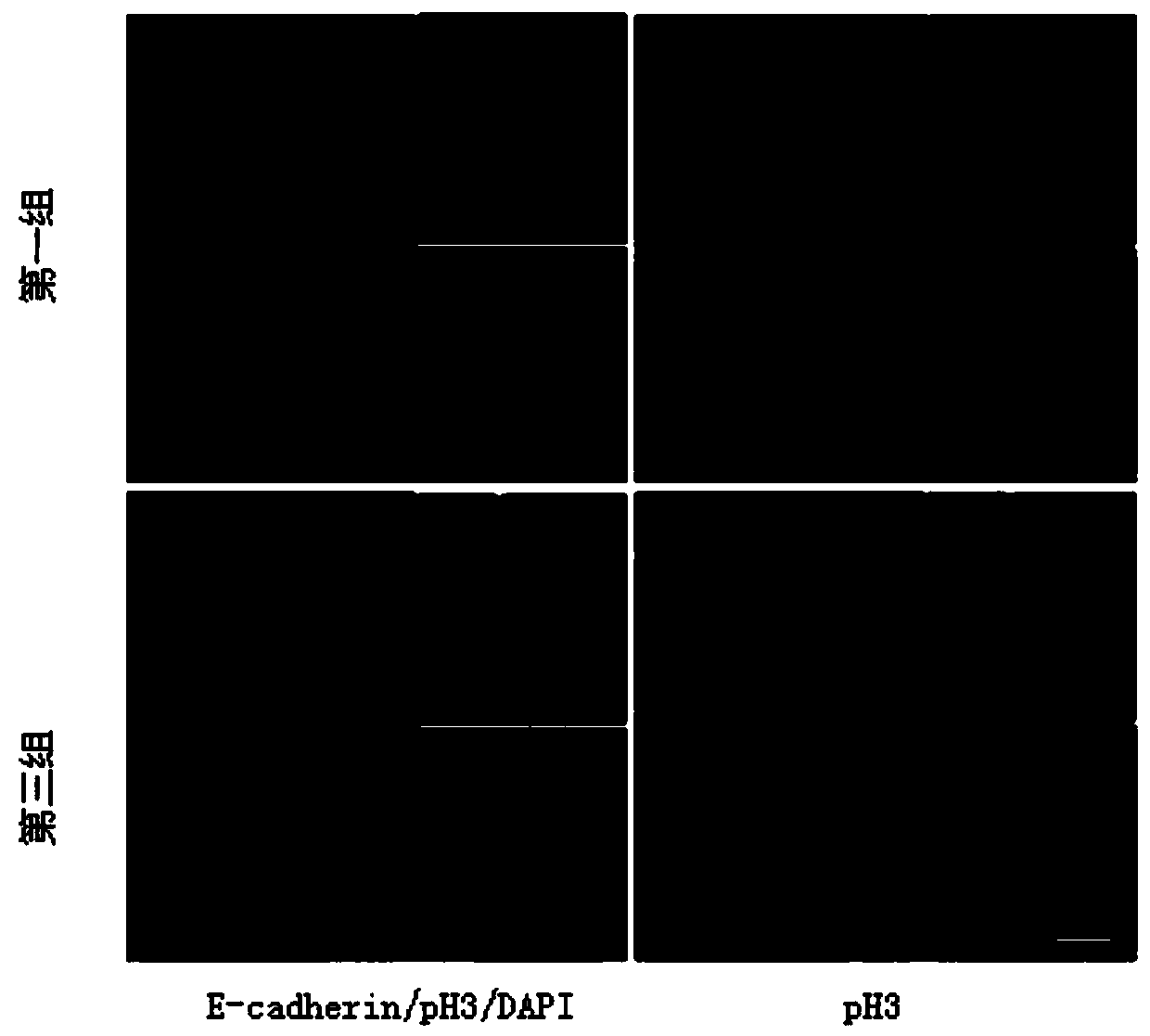 Animal model with cell-in-cell (CIC) structure and preparation method thereof