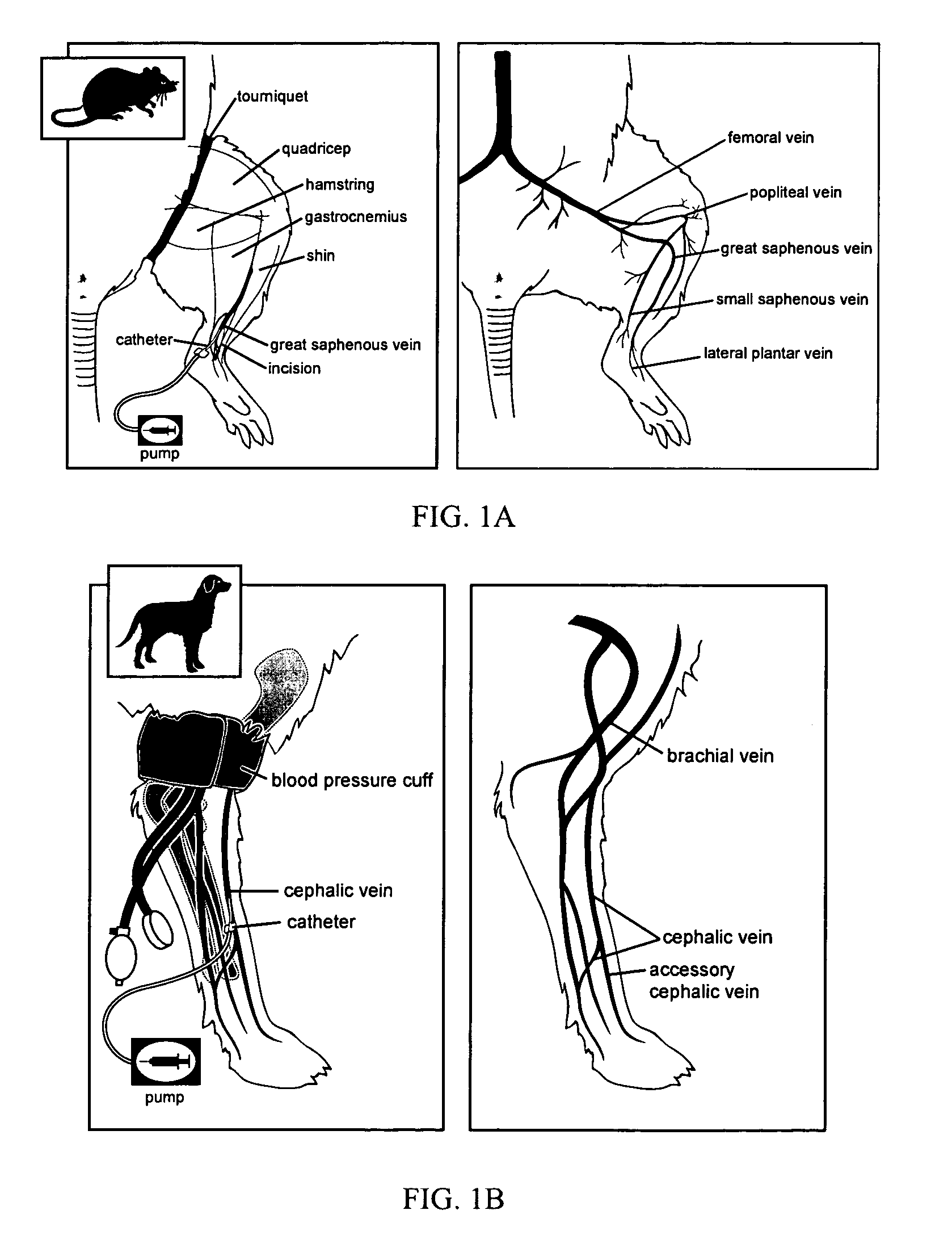 Intravascular delivery of nucleic acid