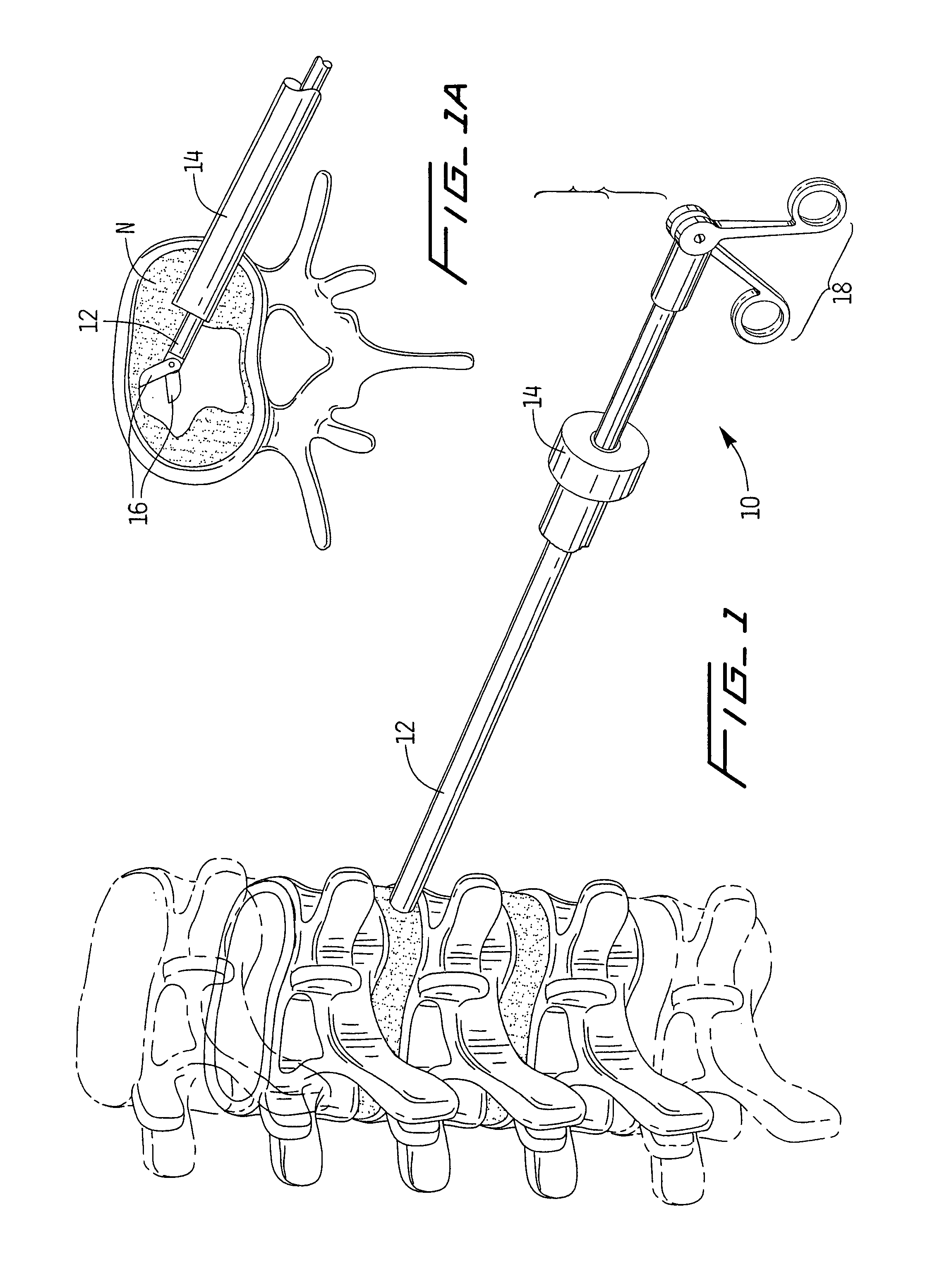 Spinal implant and method of use