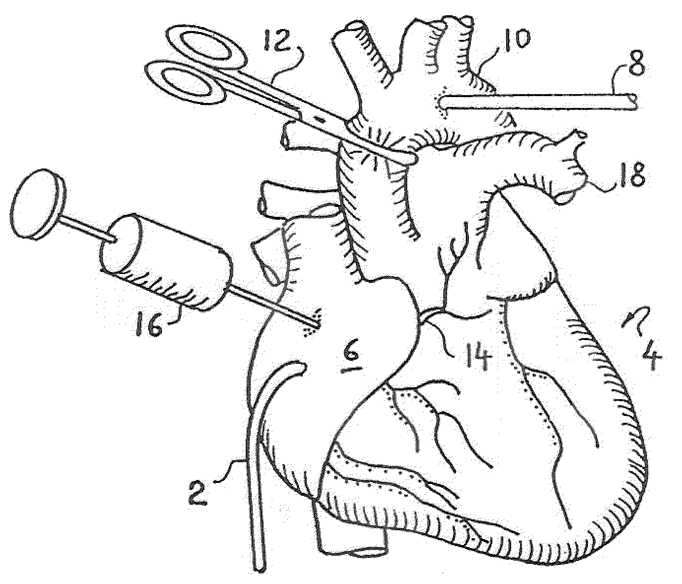 Two-part clamping device