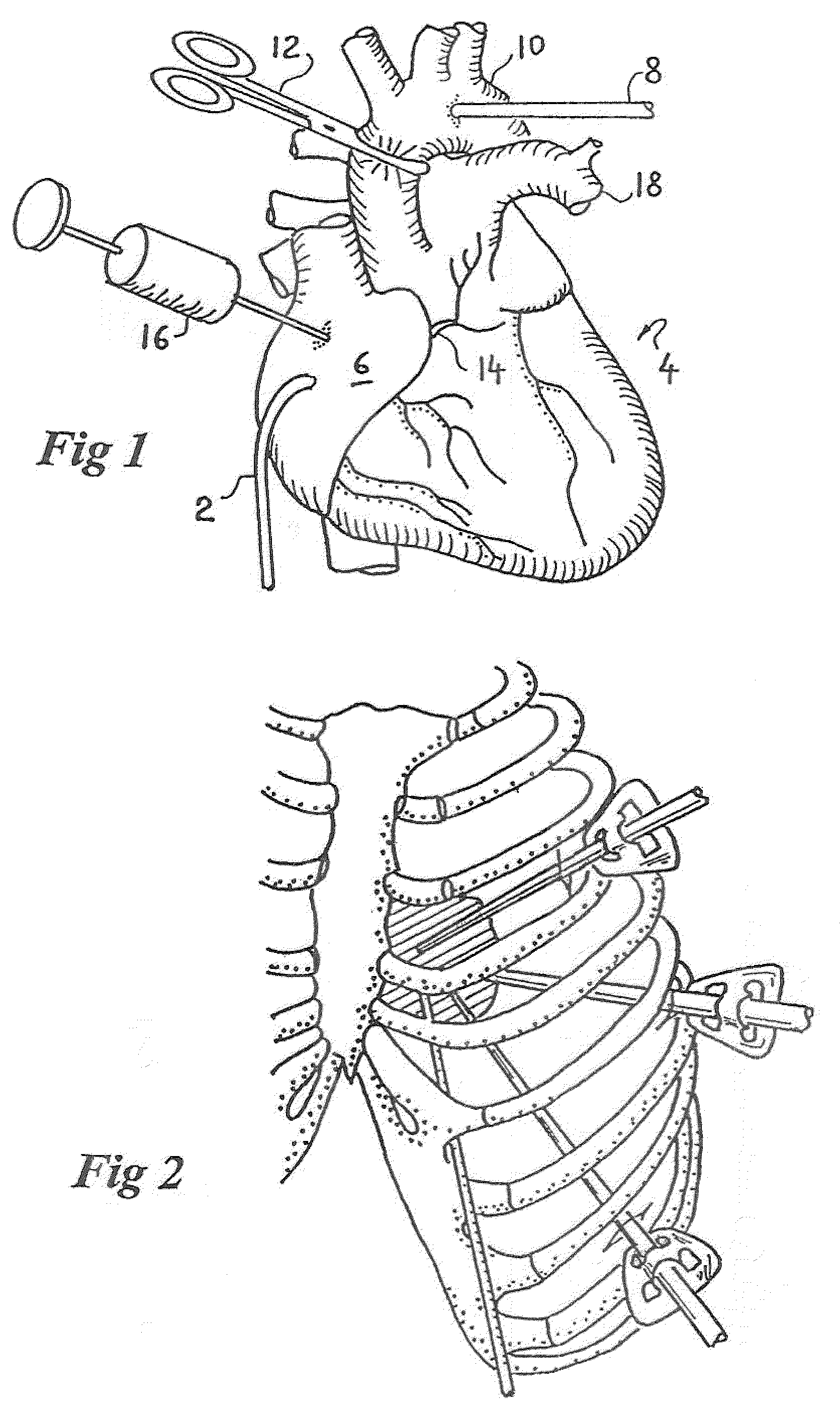 Two-part clamping device