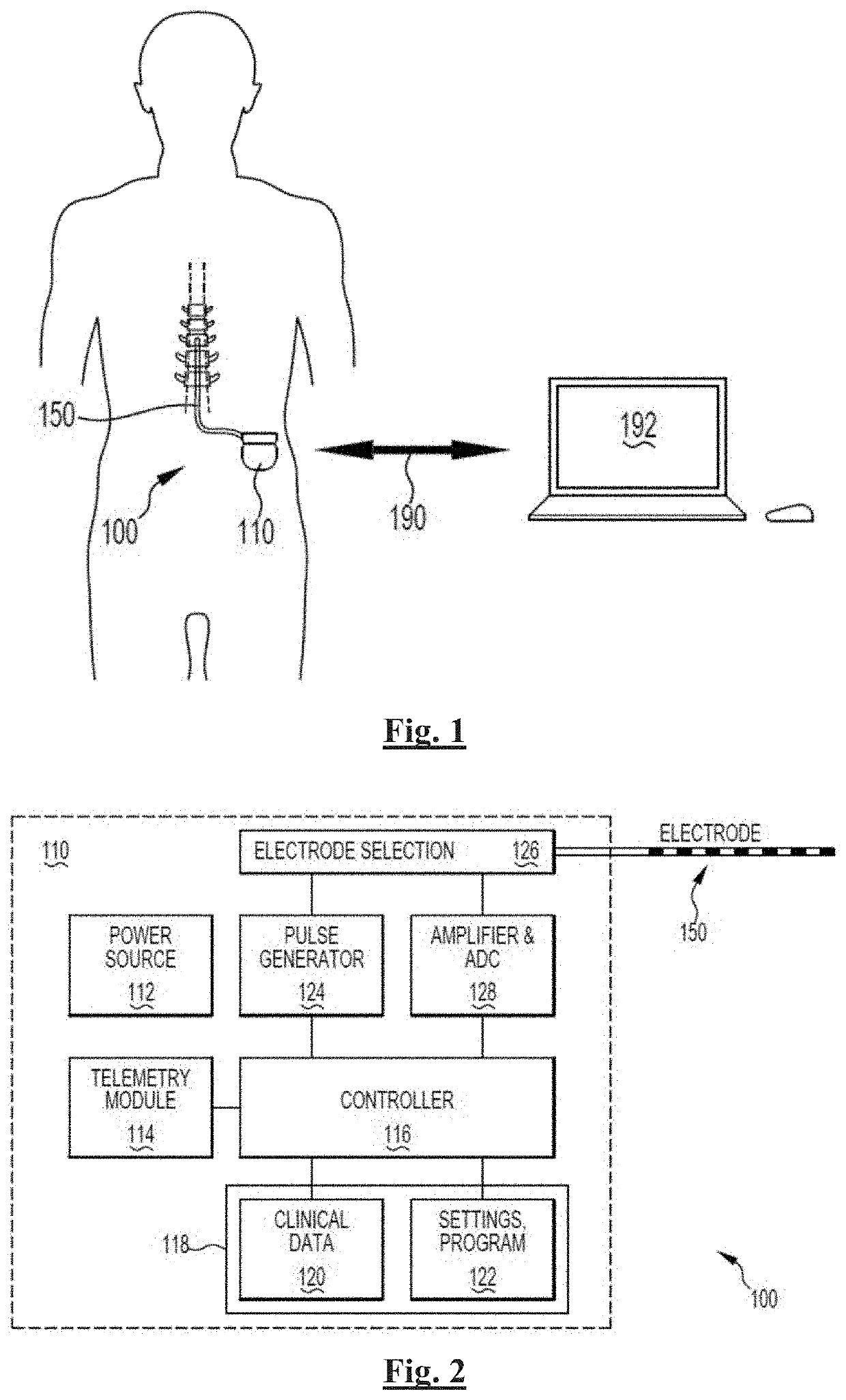 Automated Neural Conduction Velocity Estimation