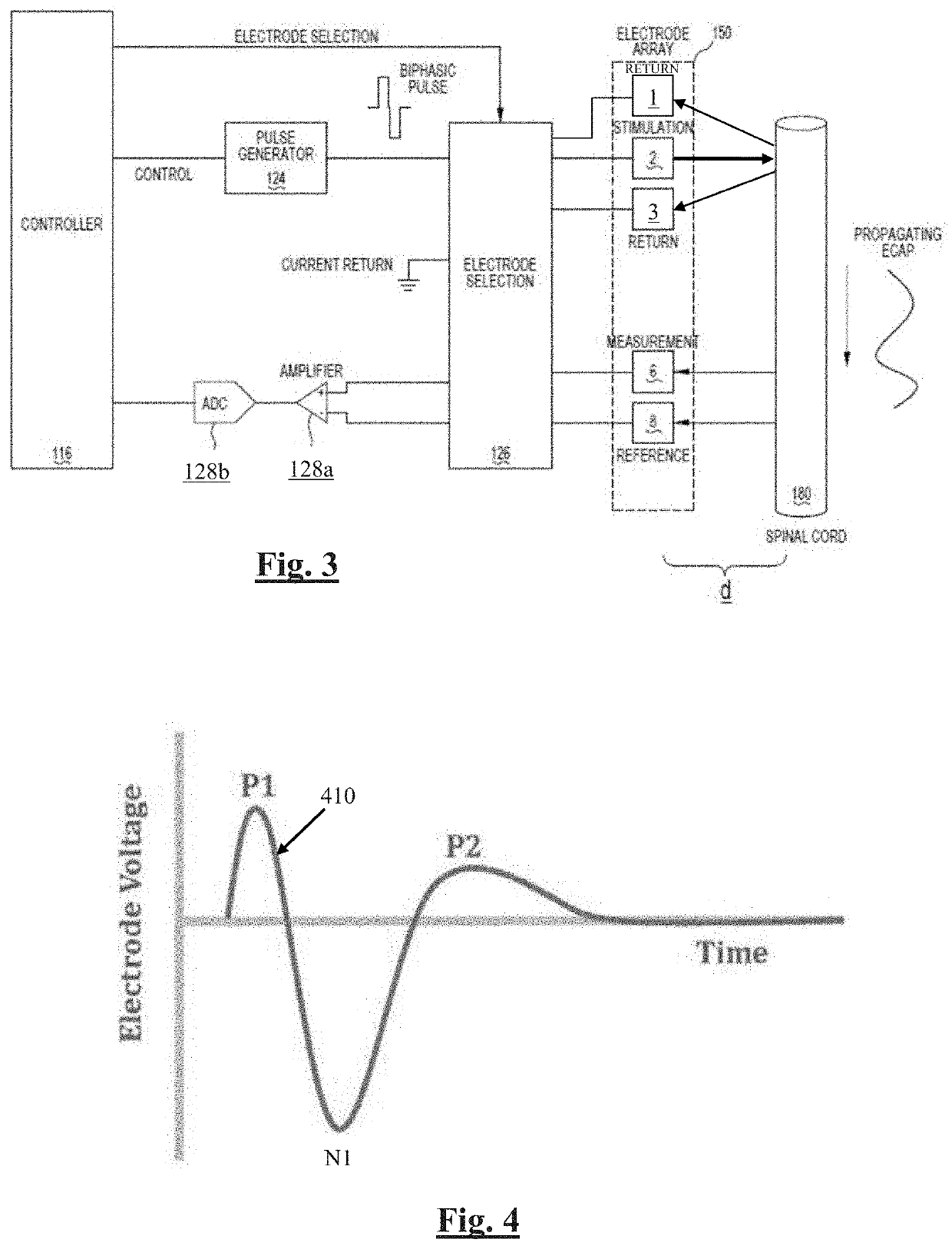 Automated Neural Conduction Velocity Estimation