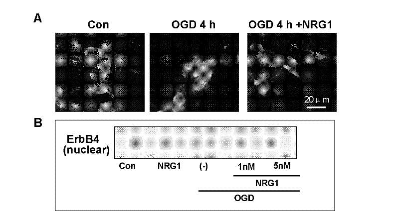 Application of ErbB receptor agonist in preparing medicines for treating ischemic cerebrovascular diseases