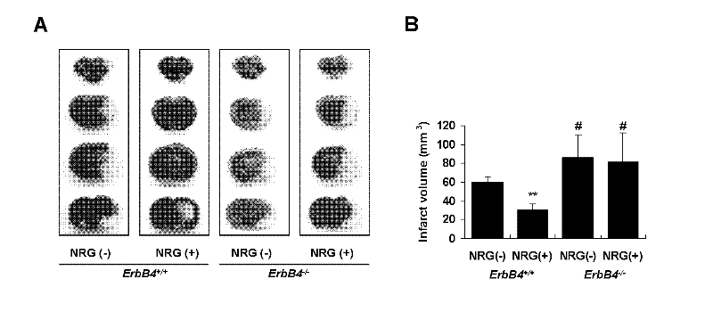 Application of ErbB receptor agonist in preparing medicines for treating ischemic cerebrovascular diseases