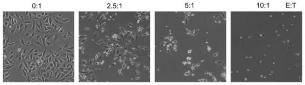 TGamma delta cell derived from tonsil as well as preparation method and application thereof