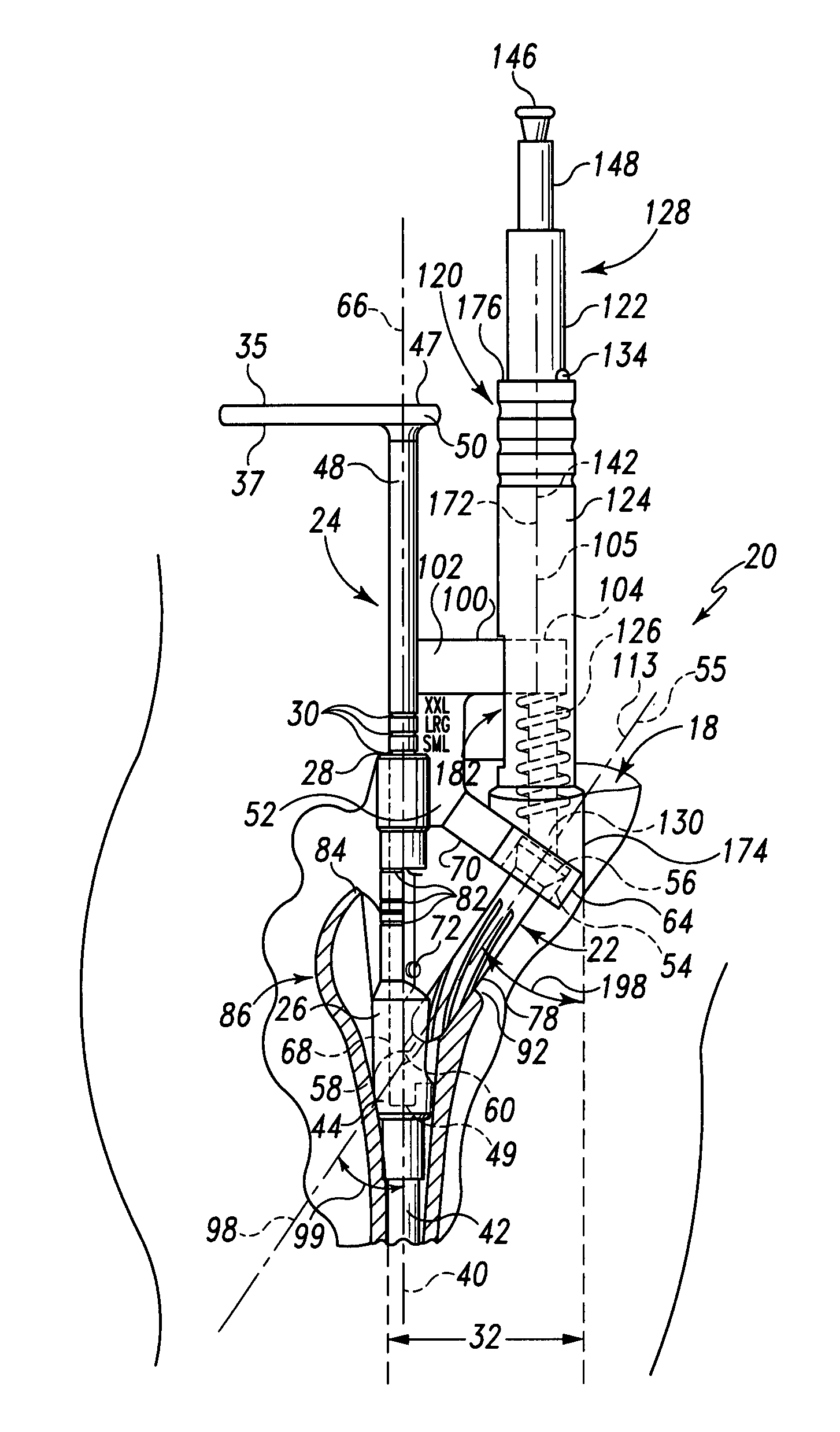 Minimally invasive bone miller apparatus