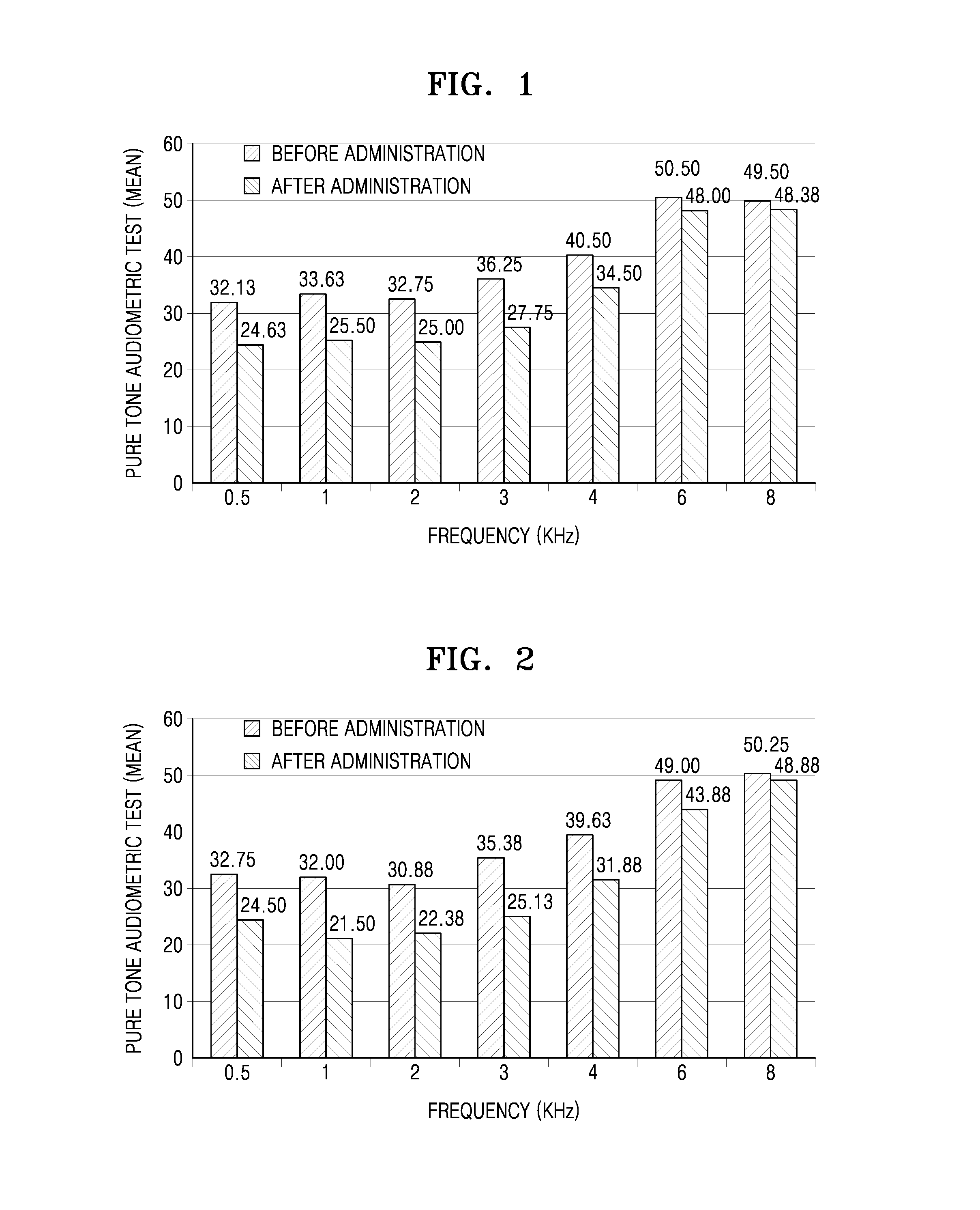 Pharmaceutical Composition For Preventing Or Treating Sensorineural Hearing Loss Or Tinnitus Including Platelet-Rich Plasma And Method Using The Same