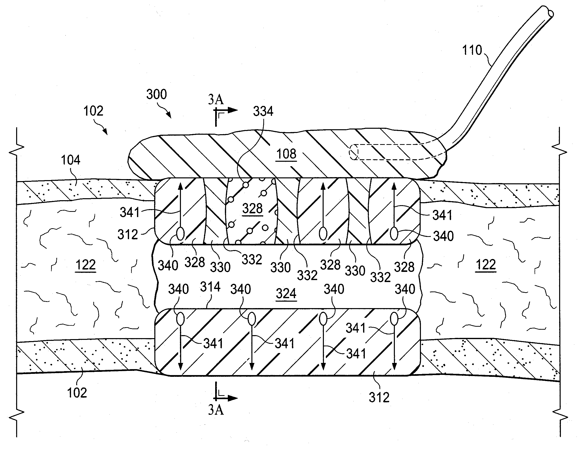 Systems for providing fluid flow to tissues