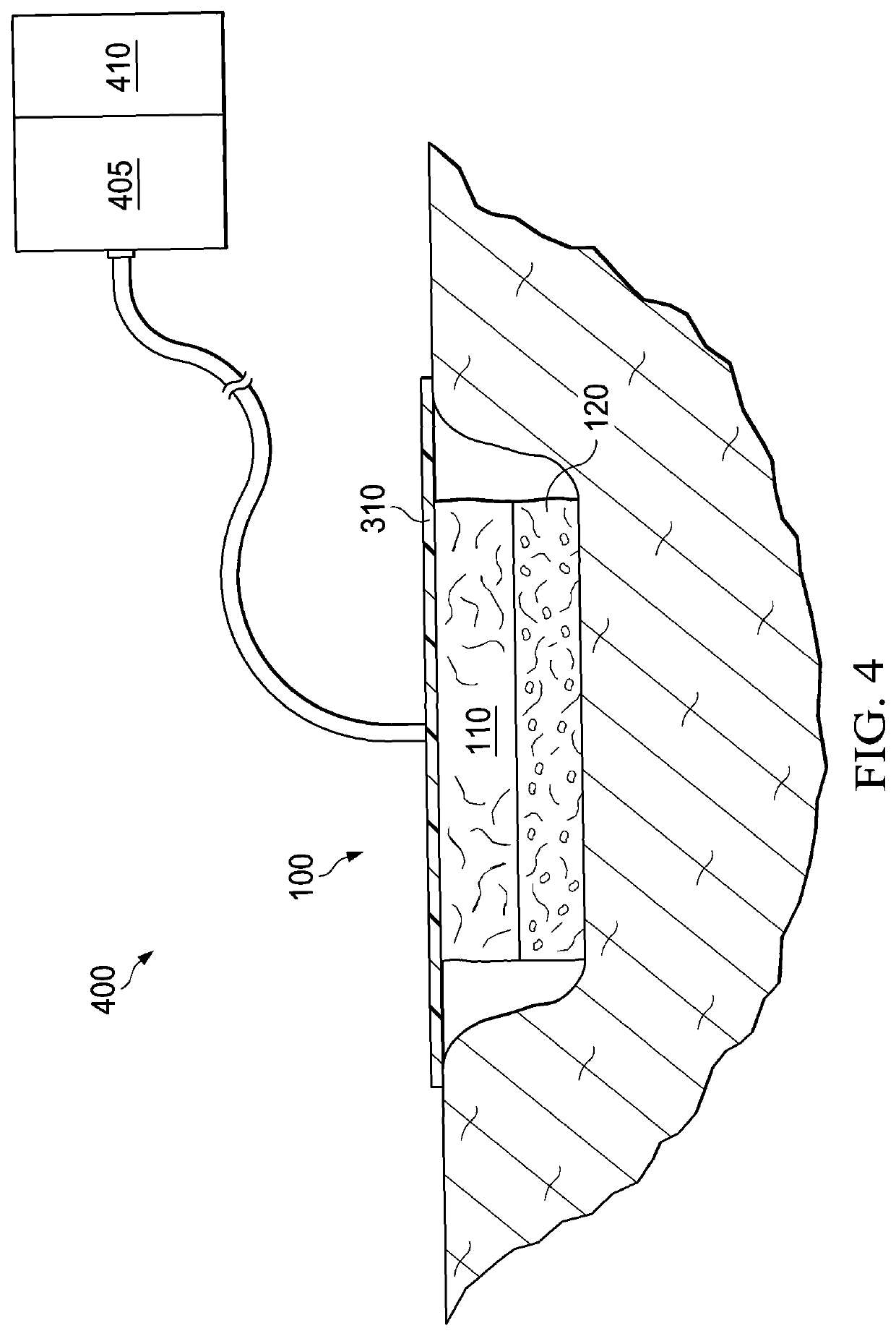 Dressing including dehydrated placental tissue for wound healing