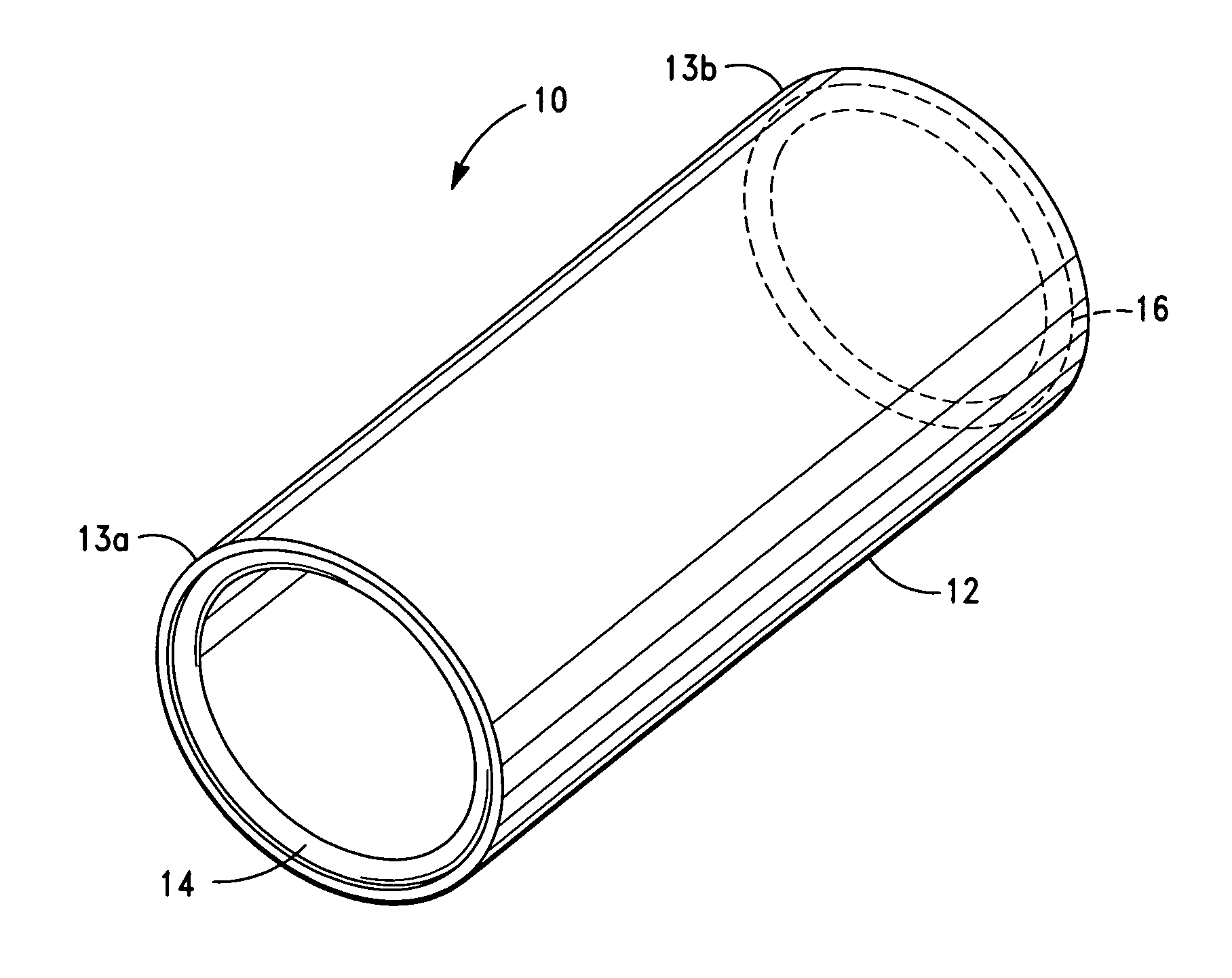 Vascular prosthesis