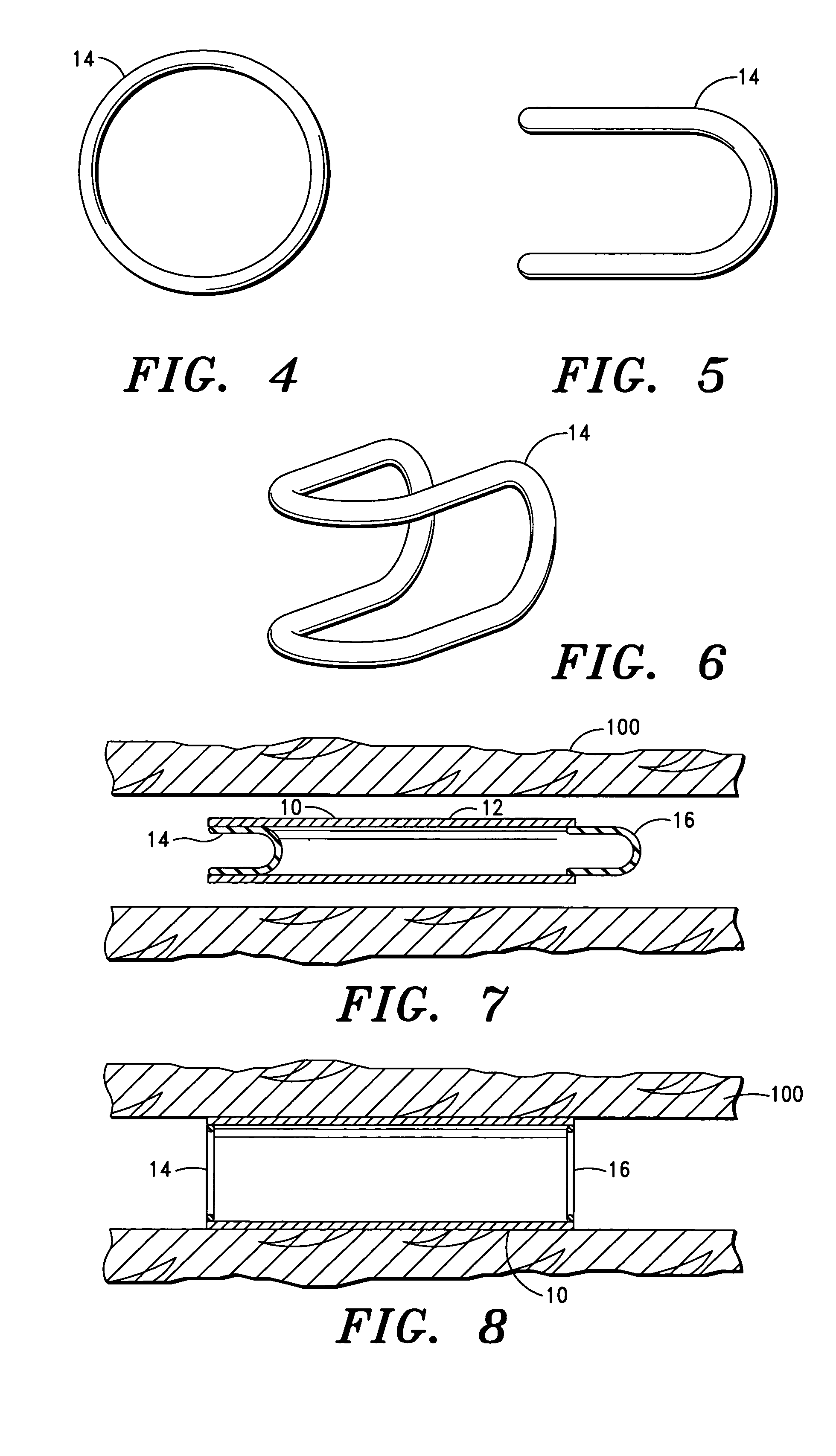 Vascular prosthesis